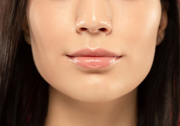 שפתיים ממבט קרוב לאחר החלמה מטיפול של עיבוי שפתיים