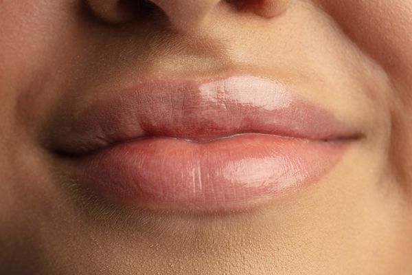 עיבוי שפתיים - צילום מקרוב